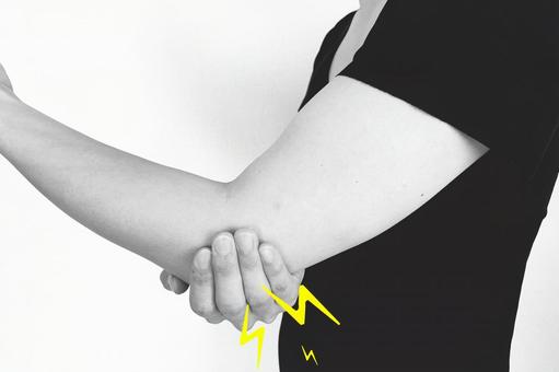 肘部管症候群の画像